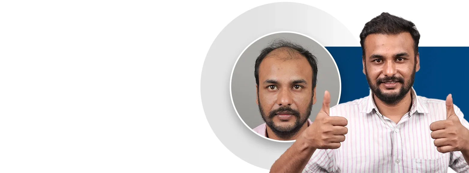 #1 Hair Clinic in India