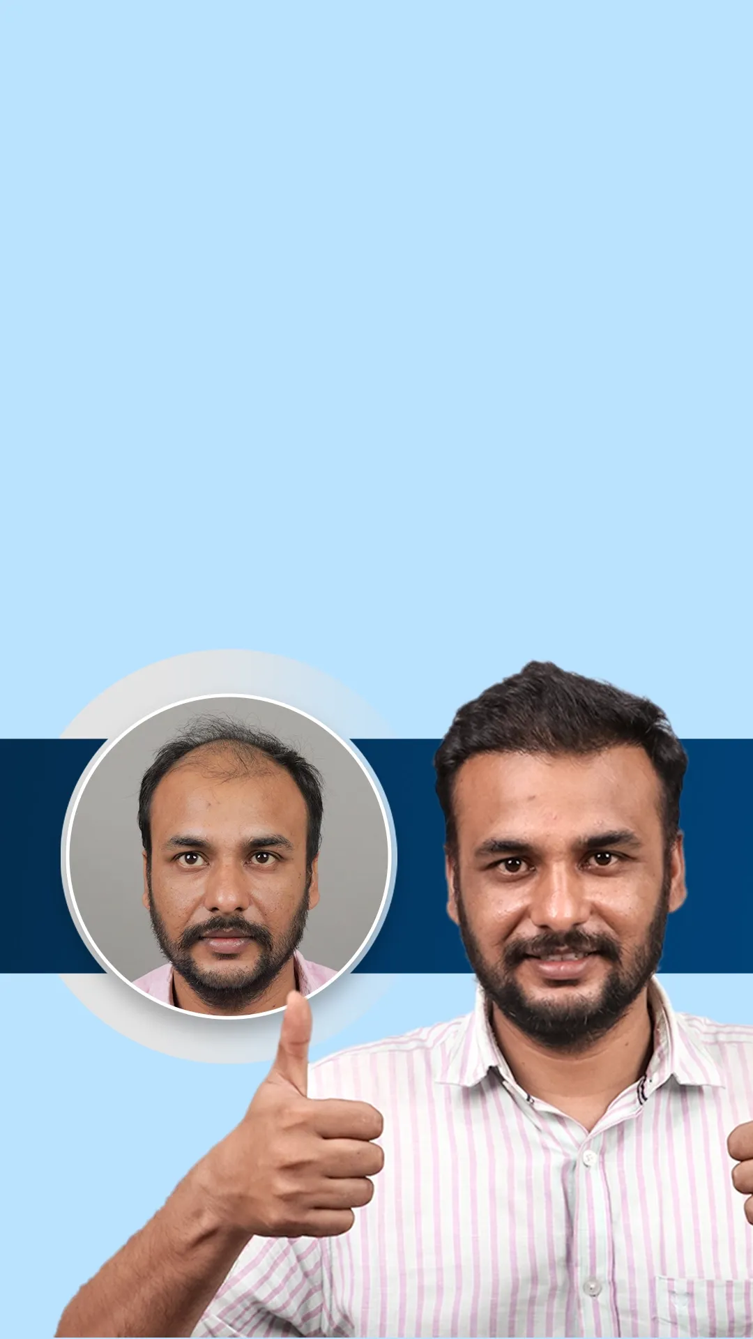 #1 Hair Clinic in India