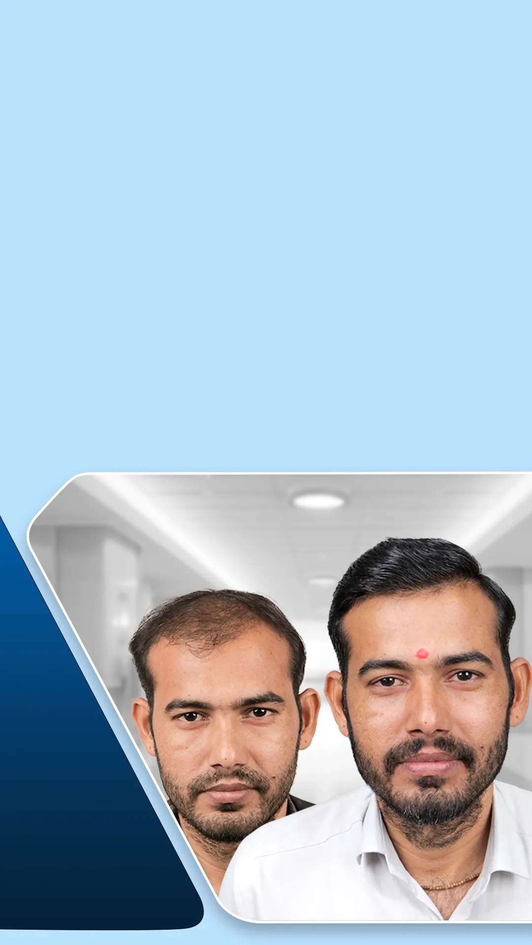 Natural Hairline Design